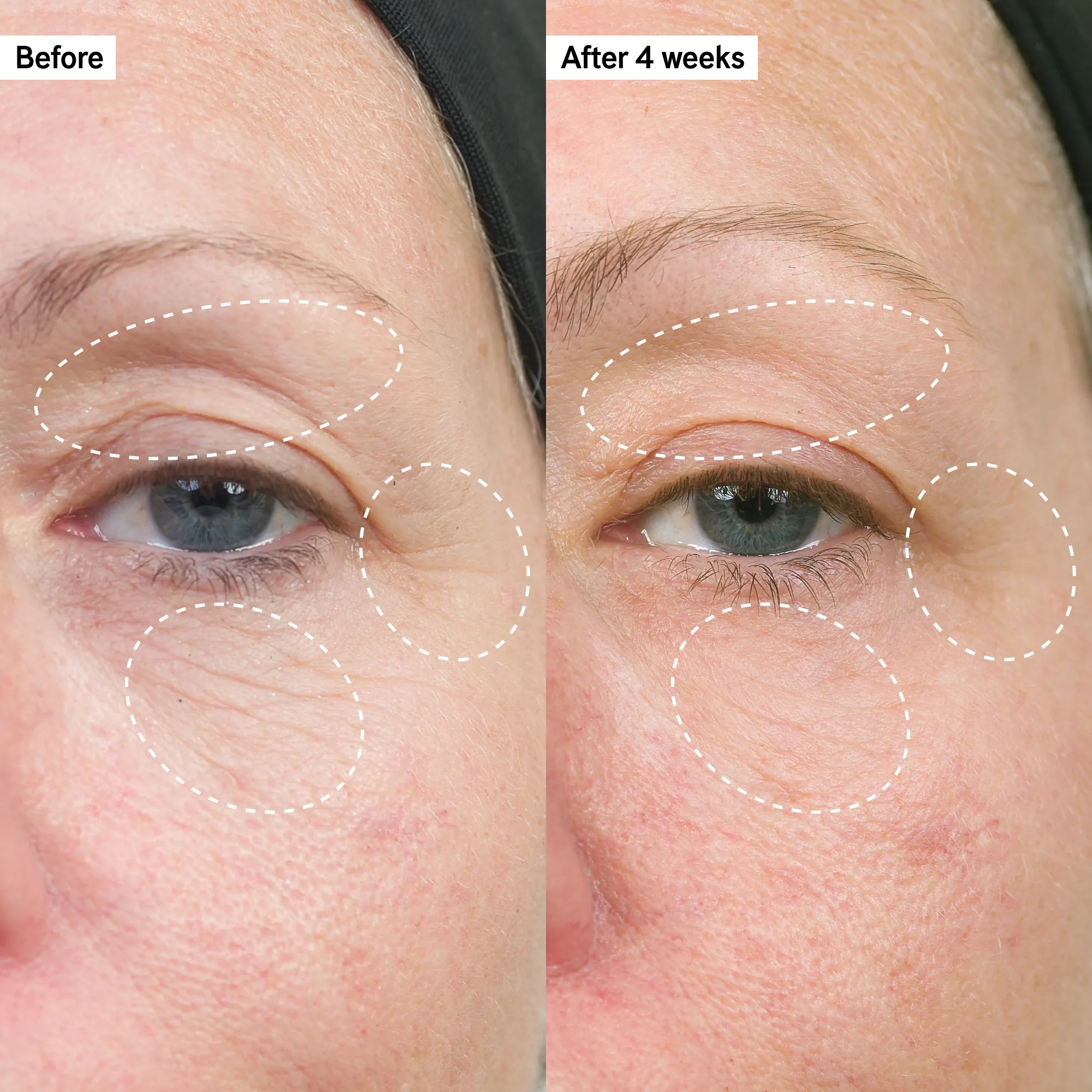 Age Defence Solution Routine